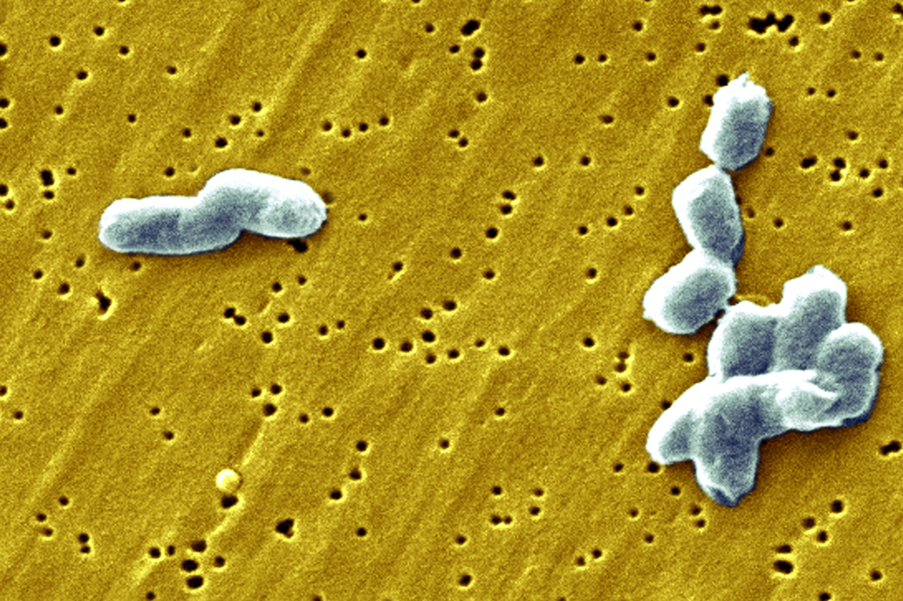 SALMONELLA INFANTIS