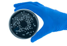 Caso di Legionella ad Alcamo, 55enne in gravi condizioni: scattano le verifiche dell’Asp
